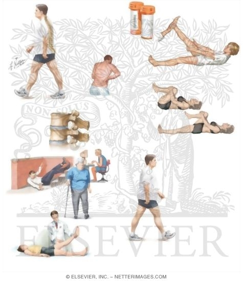 Watermarked preview of unlabeled image: Managing Your Low Back Pain