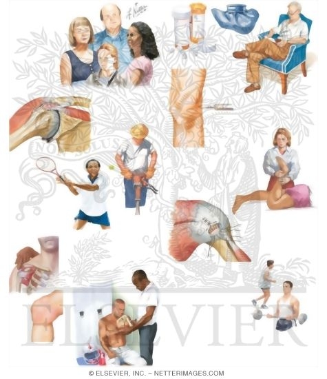 Watermarked preview of unlabeled image: Managing Your Tendinitis