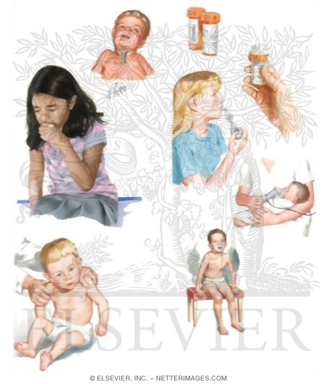 Caring for Your Child With Croup