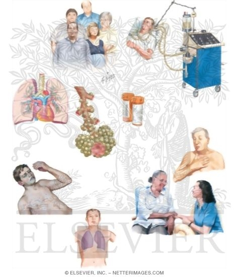 Watermarked preview of unlabeled image: Managing Your Acute Respiratory Distress Syndrome