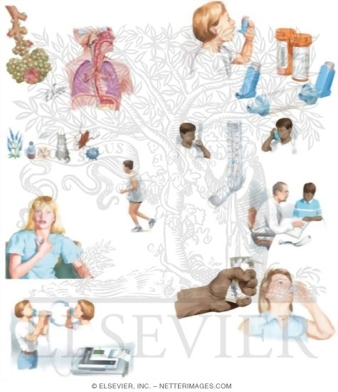 Watermarked preview of unlabeled image: Managing Your Asthma