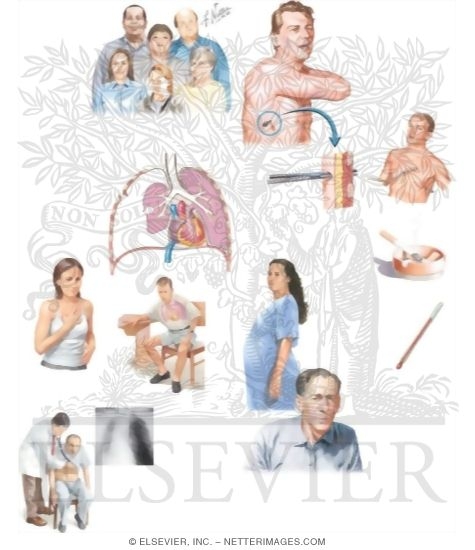Managing Your Pneumothorax