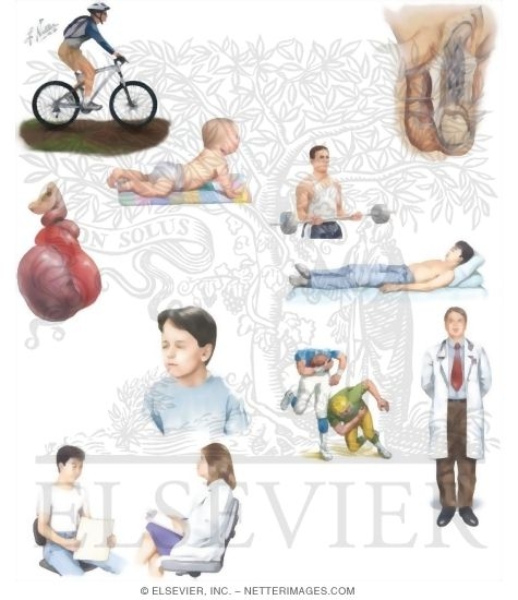 Watermarked preview of unlabeled image: Managing Your Testicular Torsion
