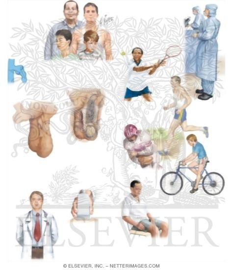 Watermarked preview of unlabeled image: Managing Your Varicocele