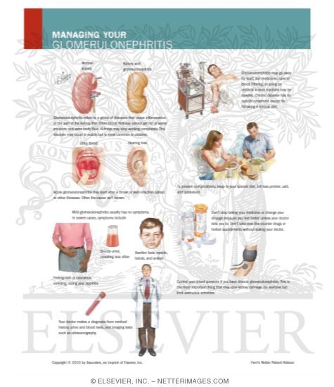 Watermarked preview of labeled image: Managing Your Glomerulonephritis