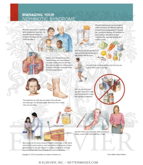 Watermarked preview of labeled image: Managing Your Nephrotic Syndrome