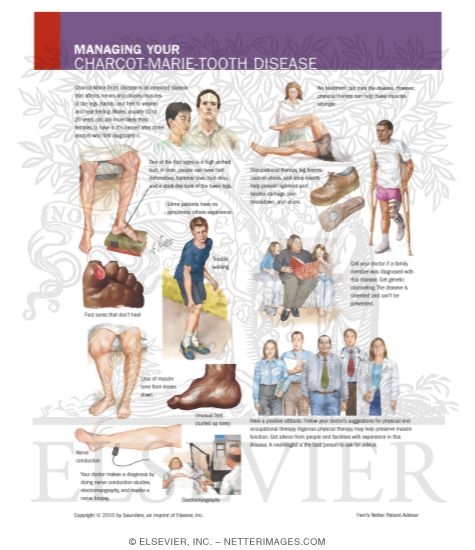 Managing Your Charcot-Marie Tooth Disease