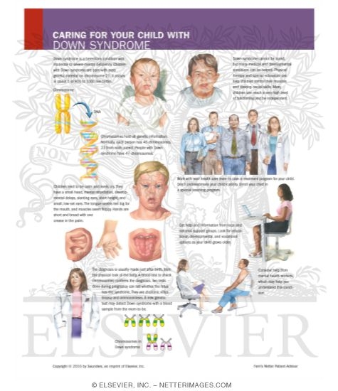 Watermarked preview of labeled image: Caring for Your Child With Down Syndrome