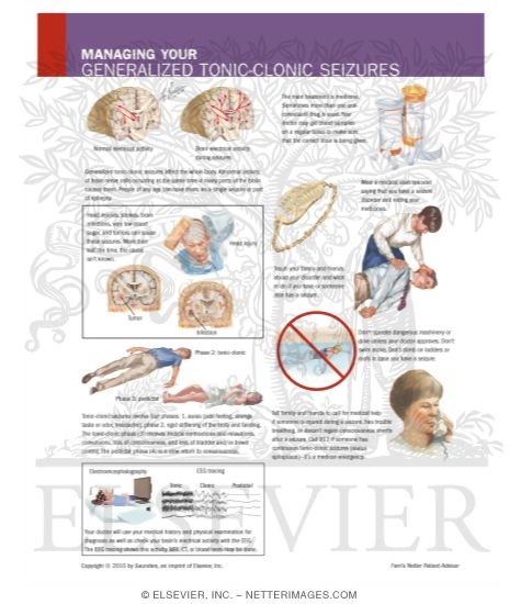 Managing Your Generalized Tonic-Clonic Seizures