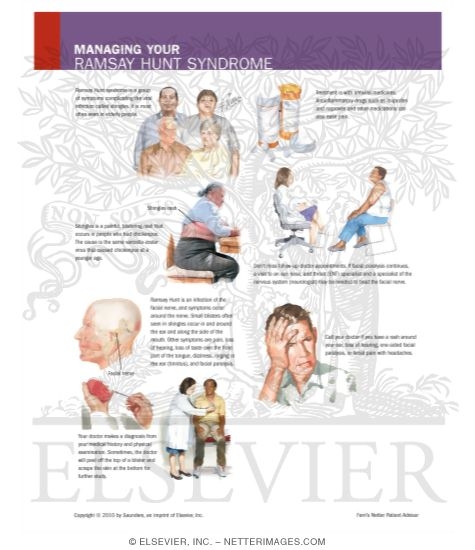 Watermarked preview of labeled image: Managing Your Ramsay Hunt Syndrome