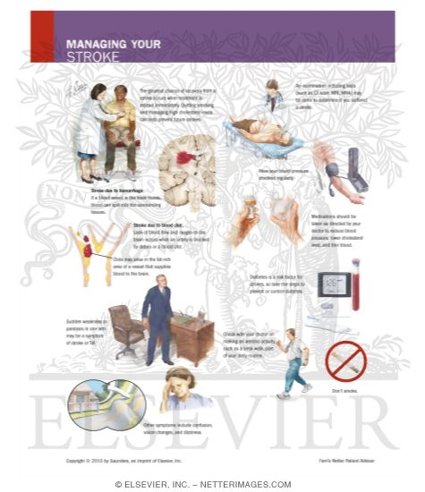 Watermarked preview of labeled image: Managing Your Stroke