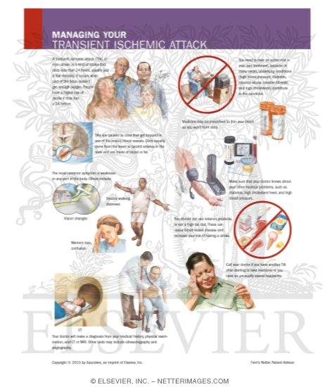 Managing Your Transient Ischemic Attack