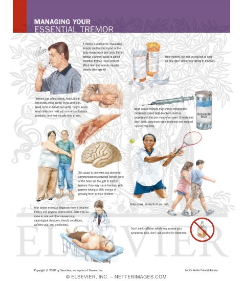 Watermarked preview of labeled image: Managing Your Essential Tremor