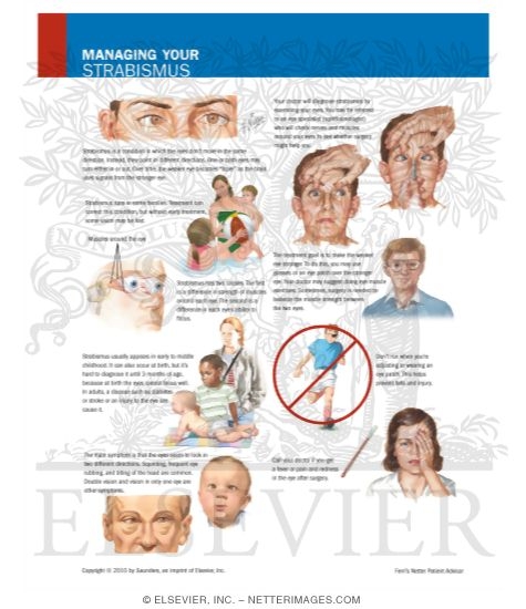 Watermarked preview of labeled image: Managing Your Strabismus
