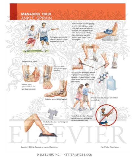 Watermarked preview of labeled image: Managing Your Ankle Sprain