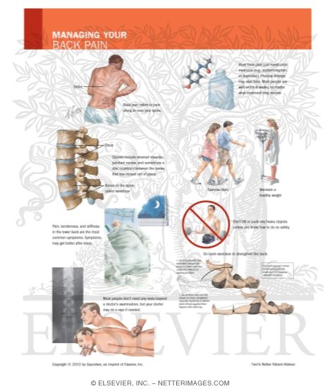 Watermarked preview of labeled image: Managing Your Back Pain