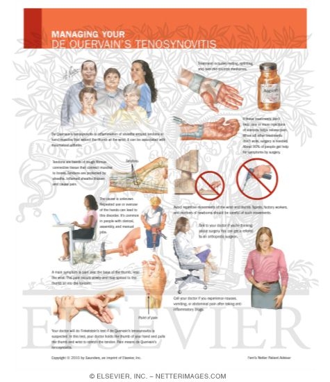 Watermarked preview of labeled image: Managing Your DeQuervain's Tenosynovitis