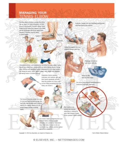 Watermarked preview of labeled image: Managing Your Tennis Elbow