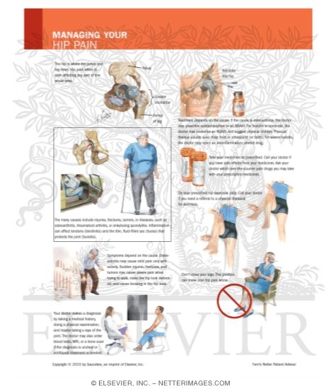 Watermarked preview of labeled image: Managing Your Hip Pain