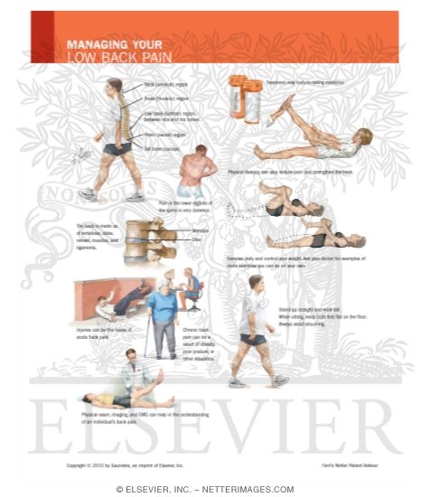 Watermarked preview of labeled image: Managing Your Low Back Pain