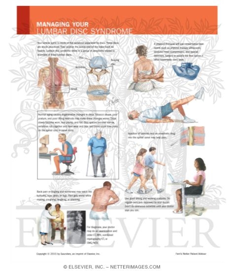 Watermarked preview of labeled image: Managing Your Lumbar Disc Syndrome