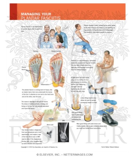 Managing Your Plantar Fasciitis