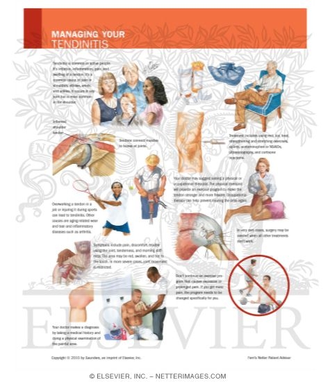 Watermarked preview of labeled image: Managing Your Tendinitis
