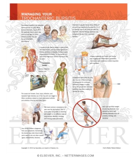 Watermarked preview of labeled image: Managing Your Trochanteric Bursitis