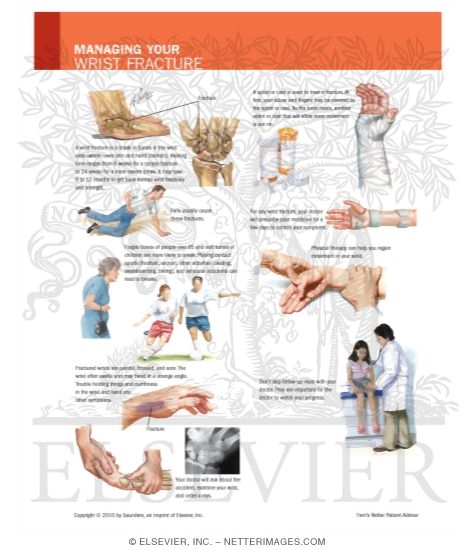 Watermarked preview of labeled image: Managing Your Wrist Fracture