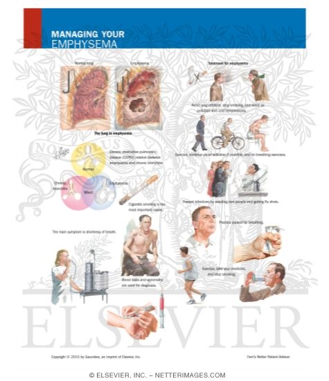 Watermarked preview of labeled image: Managing Your Emphysema