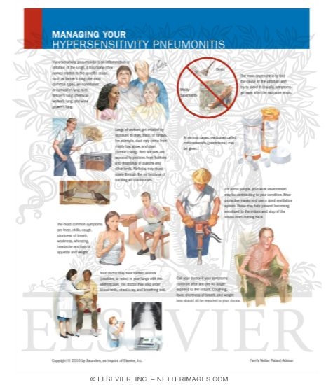 Watermarked preview of labeled image: Managing Your Hypersensitivity Pneumonitis