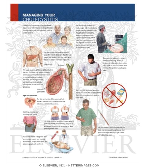 Watermarked preview of labeled image: Managing Your Cholecystitis