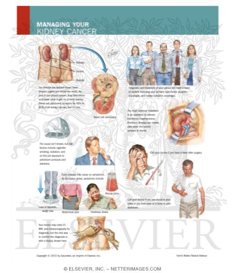 Watermarked preview of labeled image: Managing Your Kidney Cancer