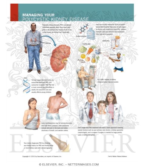 Watermarked preview of labeled image: Managing Your Polycystic Kidney Disease