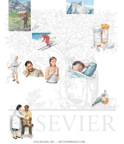 Watermarked preview of unlabeled image: Managing Your Altitude Sickness