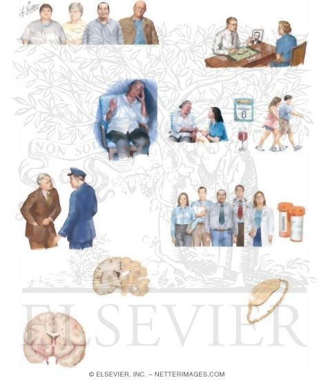 Watermarked preview of unlabeled image: Managing Your Forgetfulness