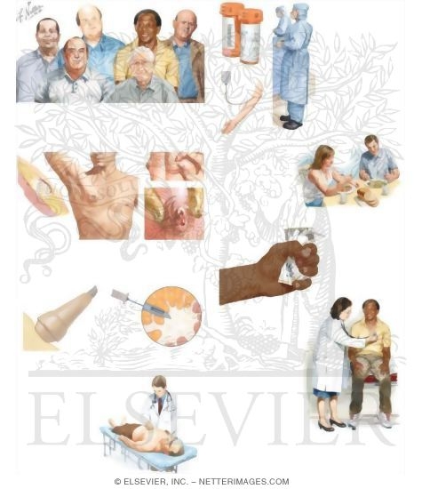 Watermarked preview of unlabeled image: Managing Your Breast Cancer: For Men