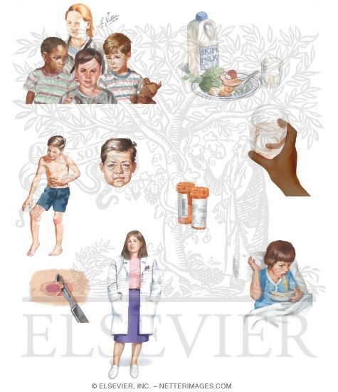 Watermarked preview of unlabeled image: Caring for Your Child With Henoch-Schonlein Purpura