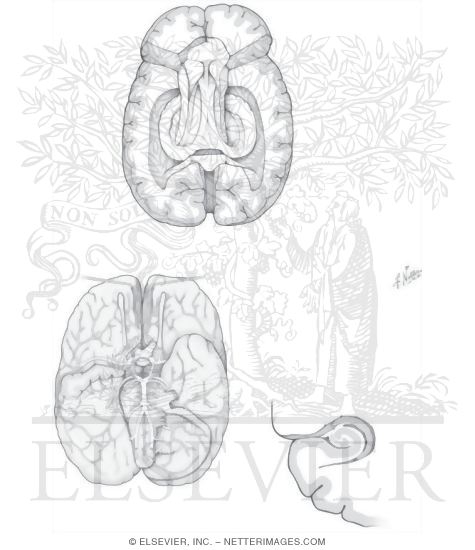 Watermarked preview of unlabeled image: Central Nervous System: Brain