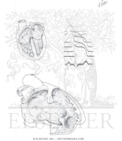 Watermarked preview of unlabeled image: Cardiopulmonary Circulation