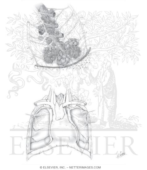 Watermarked preview of unlabeled image: Cardiopulmonary Circulation