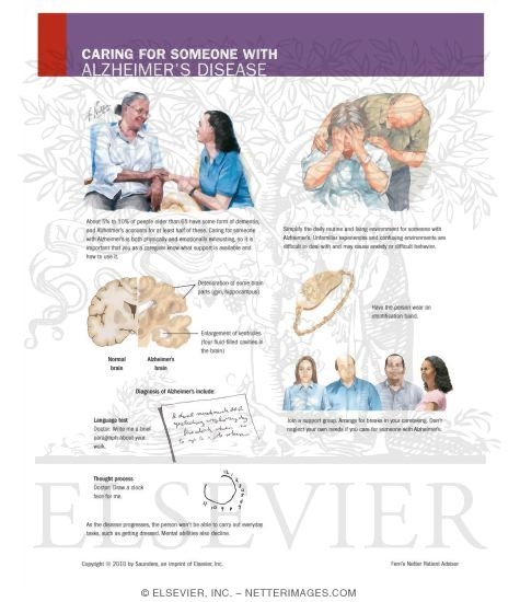 Watermarked preview of unlabeled image: Caring for Someone With Alzheimer's Disease