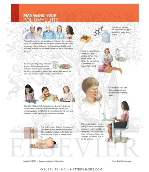 Watermarked preview of unlabeled image: Managing Your Poliomyelitis