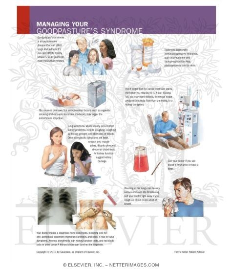 Managing Your Goodpasture's Syndrome
