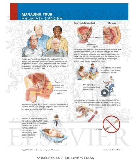 Watermarked preview of unlabeled image: Managing Your Prostate Cancer