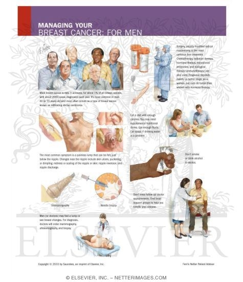 Watermarked preview of unlabeled image: Managing Your Breast Cancer: For Men