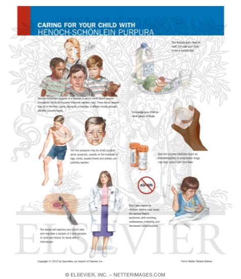 Caring for Your Child With Henoch-Schonlein Purpura