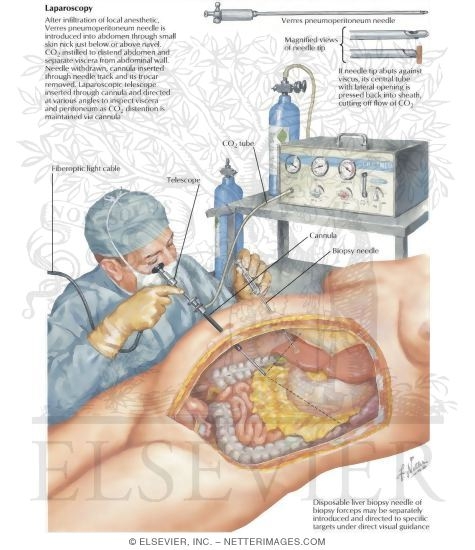 Watermarked preview of labeled image: Laparoscopy