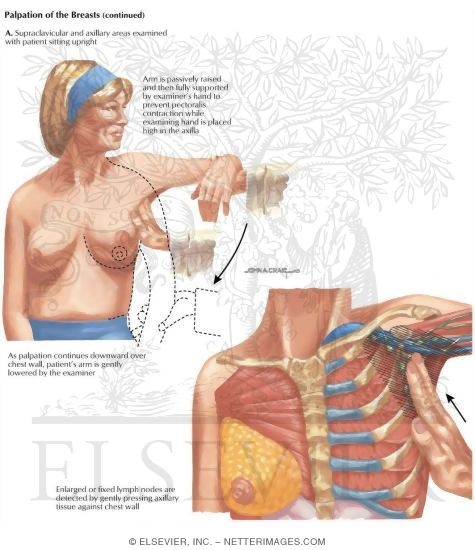 Watermarked preview of labeled image: Breast Tumors: Palpation of the Breast