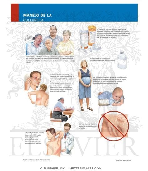 Managing Your Shingles